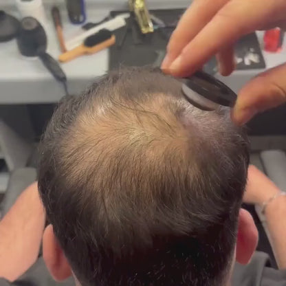 Hair Density Filler